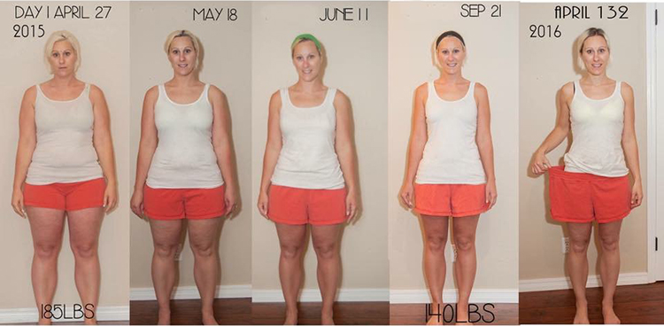Emma W - Before and After