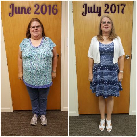 Judith J Before - After