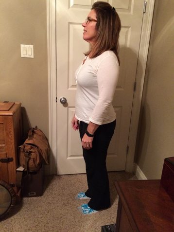 Karen L Before 3