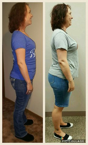 Amanda D Before and After