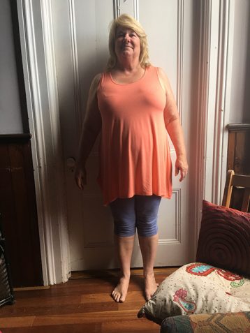 Mary F Before