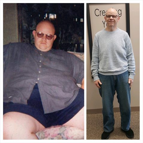 Mark R Before - After